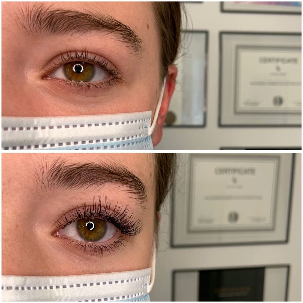 Before and after Kanata eyelash extensions