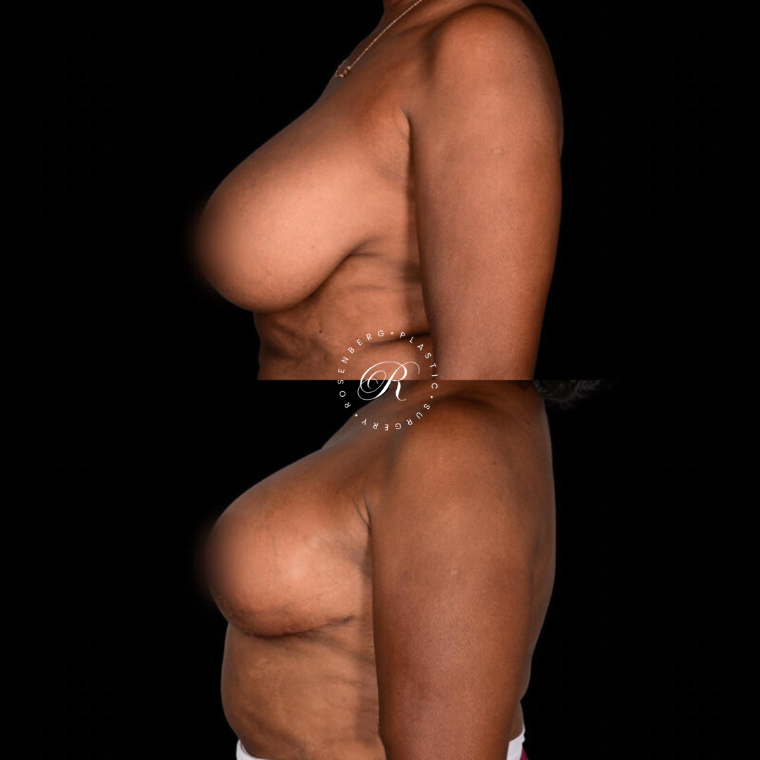 Copy of Template for Rosenberg Plastic Surgery B.zip - 28