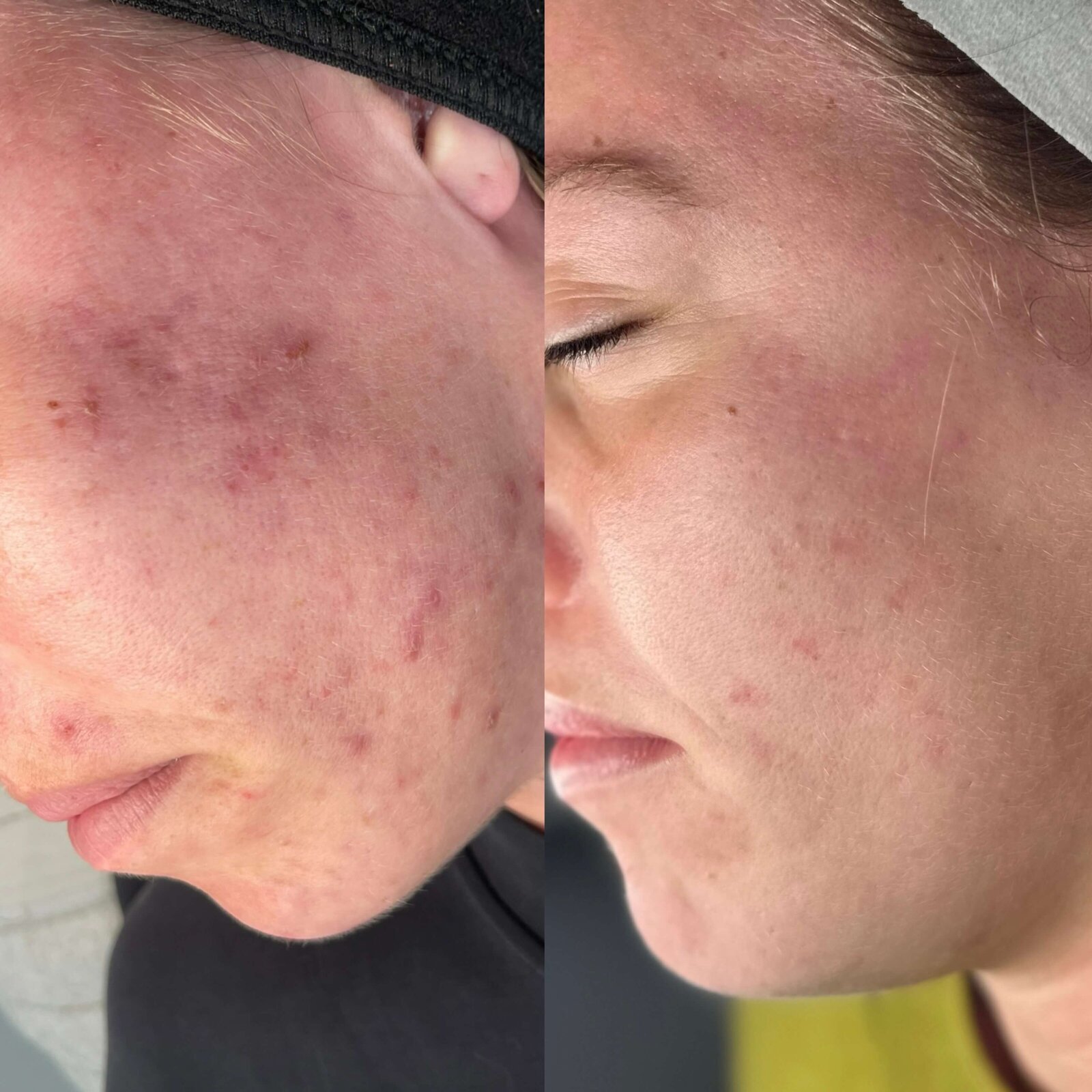 42B4629A-A561-4F9E-933F-463EB8396BFD