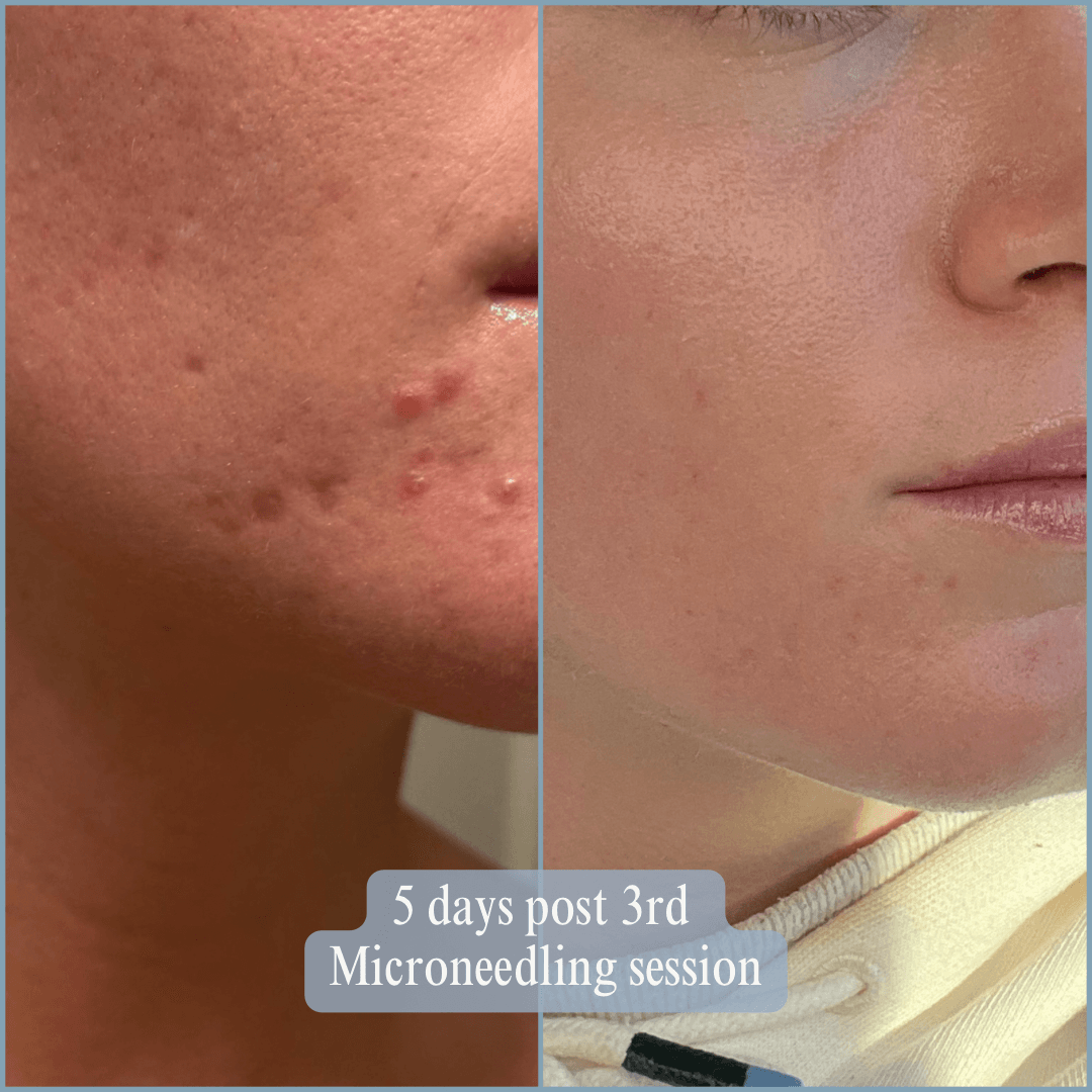 313A3FC7-C5F5-4690-AD84-233A19FA5B4A