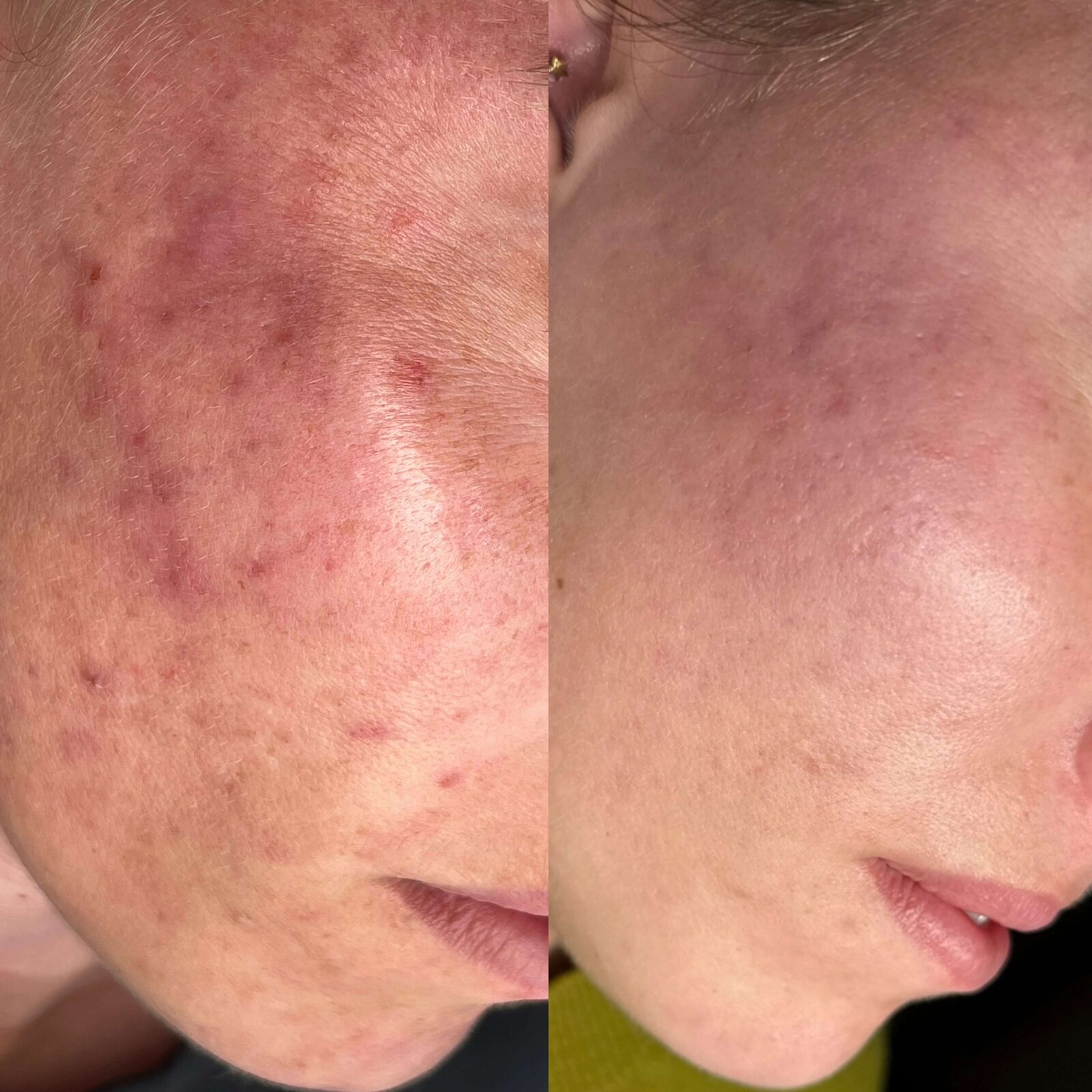 2F369912-B615-4A05-81B4-DECC3396E7EA