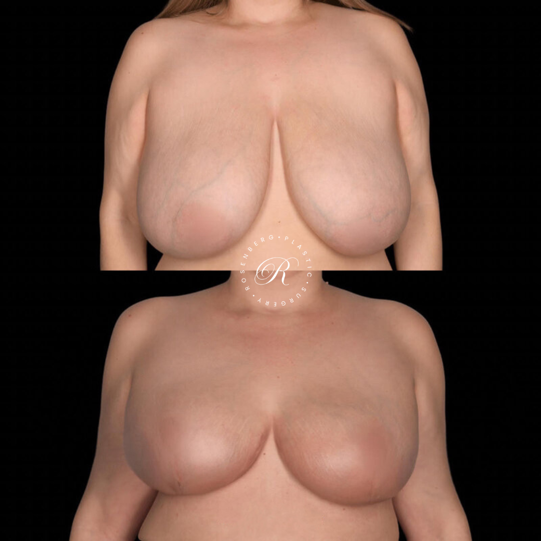 Copy of Template for Rosenberg Plastic Surgery B.zip - 22