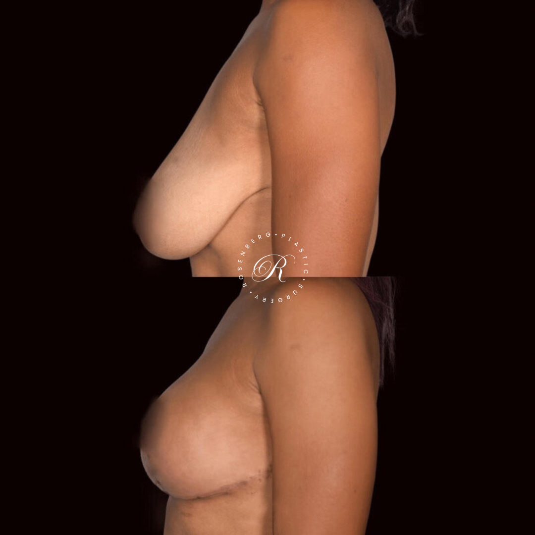 Copy of Template for Rosenberg Plastic Surgery B.zip - 5