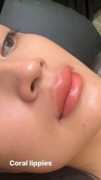 Before and after lips