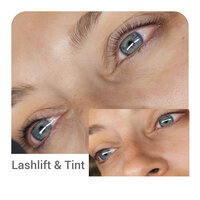 LashliftBeforeAfter