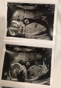 Baby Edwards _Ring Bearer 3_ - Coming Soon!