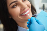Sacramento_Teeth_Whitening_extra_Whitening