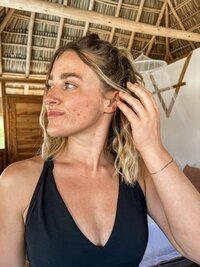 yoga woman with mild acne showing natural skin in self-love light