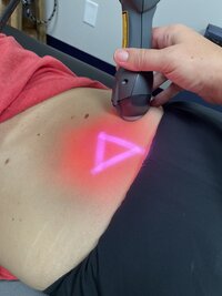 MLS laser therapy care in sterling il