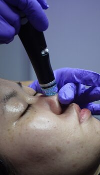 Skincare-Treatment-FL
