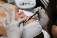 Dermaplaning in Albuquerque at Zior Skin and Body