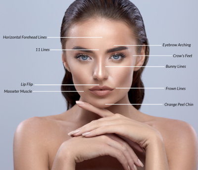 Botox treatment area