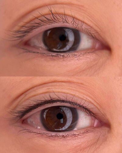 Lash Line Enhancement New York
