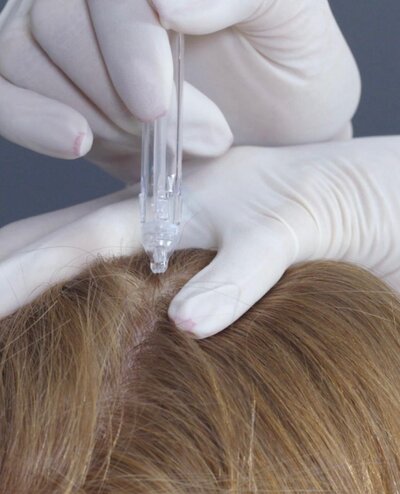 image du jetpeel capillaire