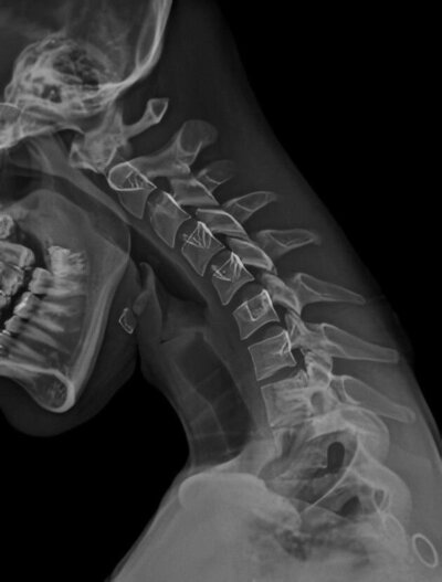 Snyder Chiropractic and Acupuncture in St. Louis - 40 years of trusted care.