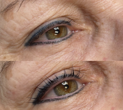 Dallas Permanent Makeup and Anti-Aging Skincare service for aging skin.