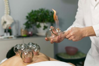Acupuncturist performing fire cupping on patient at North Shore Wellness Center Kauai