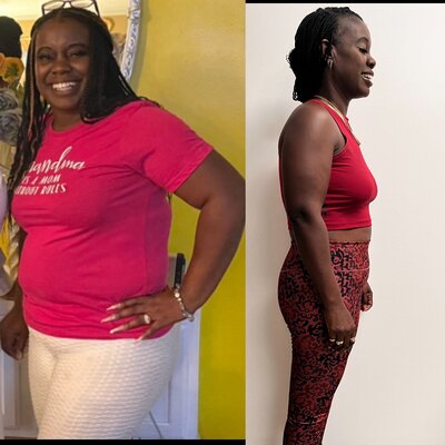 Weight Management before and after photo
