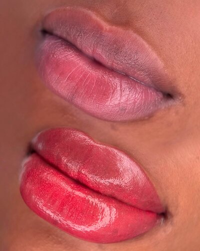 lips neutralization in New York