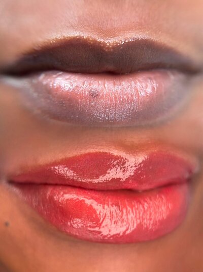 Dark Lips color correction nyc