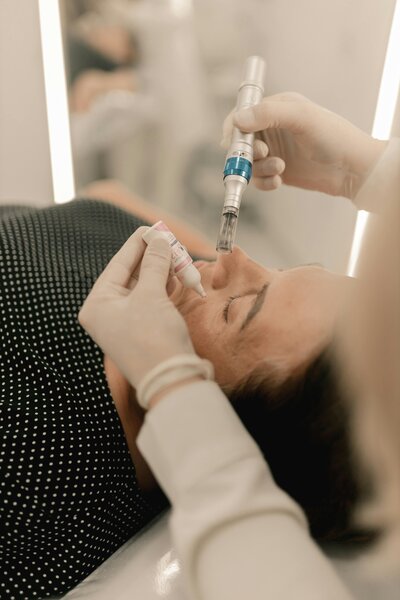 Woman receiving microneedling treatment on face