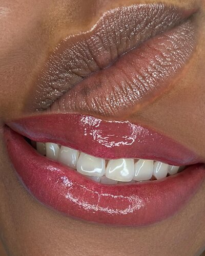 Lips Neutralization  Dark Lips Color Correction - New York