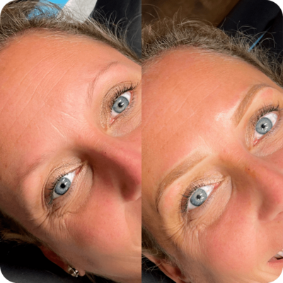Before and after powder brows of a client from Refresh Aesthetics