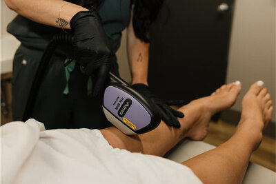 Close up of a nurse performing a laser hair removal treatment on a patients legs at RMWC.