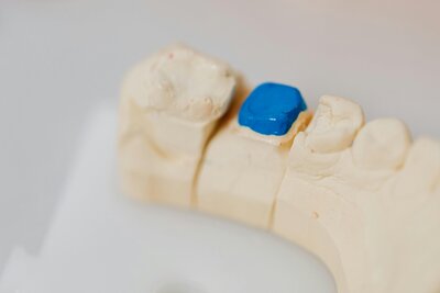 Dentures fitted with bite blocks, enhancing stability and proper jaw alignment.