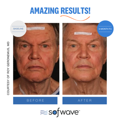 Set-28-Full-Face