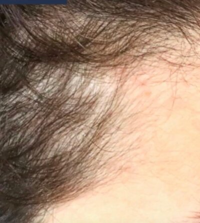 avant après soins cheveux