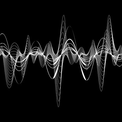 Abstract image of sound waves representing a vibrator used for pain relief and nervous system distraction.