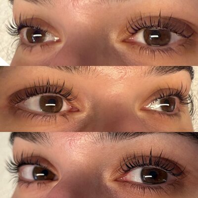 This set of before-and-after photos highlights the amazing results of a lash lift performed by Book Sothana in Jacksonville, FL. Lash lifts naturally curl and lift the lashes from the root, creating a brighter, more awake appearance without the need for lash extensions. Perfect for low-maintenance beauty lovers, a lash lift lasts 6–8 weeks with proper care. Licensed esthetician Sothana uses gentle, high-quality solutions to protect the health of your natural lashes while achieving stunning results. Whether you pair your lift with a lash tint for even more definition or keep it natural, you’ll enjoy effortless, beautiful lashes every day. Clients appreciate the professional care, customized curl options, and the relaxing, spa-like atmosphere at Book Sothana. Located at 9303 Baymeadows Rd 105, #120, Jacksonville, FL 32256. Book your lash lift service today by calling (904) 597-0867 or visiting https://booksothana.com/.