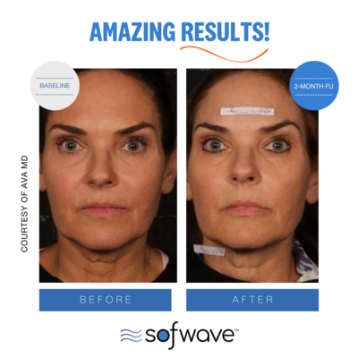 Set-26-Full-Face