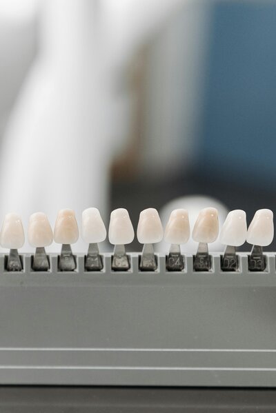 Set of custom dental veneers color chart designed to achieve a natural smile at Peak Prosthodontics in Lethbridge, Alberta.