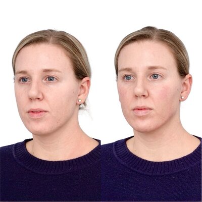 image4 (1)