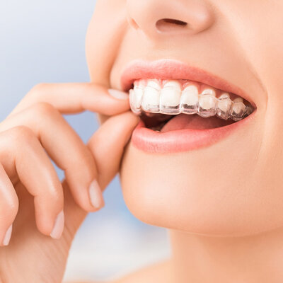invisalign is offered as a cosmetic service with Kemp Dental.