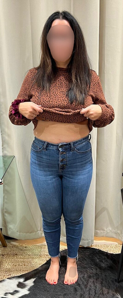 Before Front