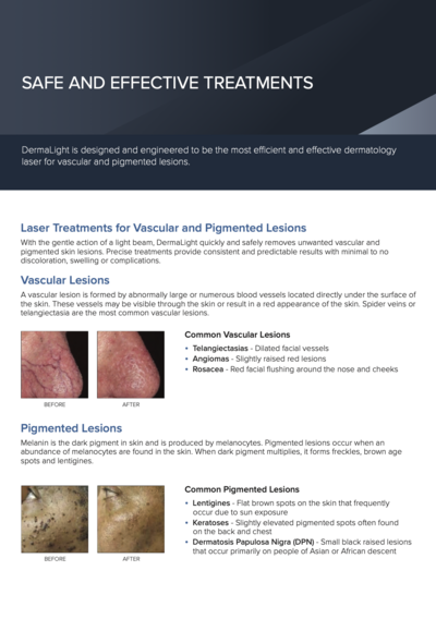 DermalLight LED system brochure for acne, pigmentation, and skin rejuvenation
