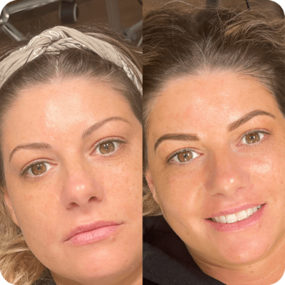 Results from a powder brow treatment - before and after