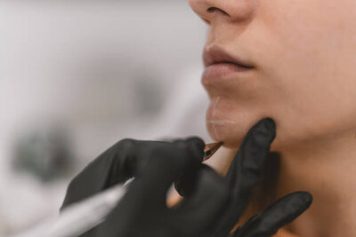 Botox Xeomin Jeuveau Dysport Daxxify treatment