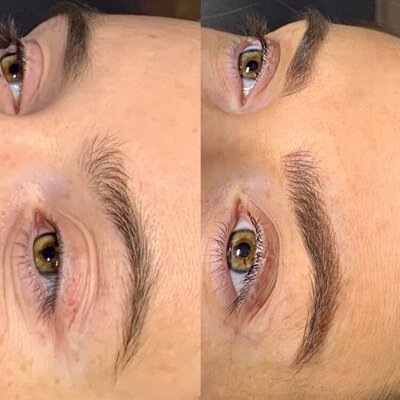 Microblading treatment on sparse eyebrows