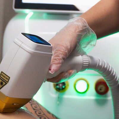 photo epilation définitive au laser
