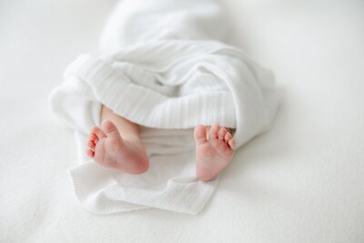 Newborn baby feet splayed 