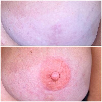 3D-Areola-Tattoo-by-Natural-Beauty-by-Kelly-2