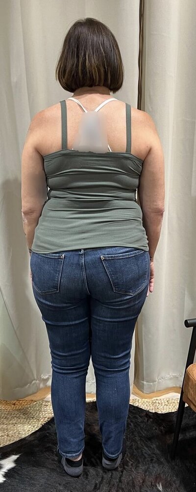 Before Back