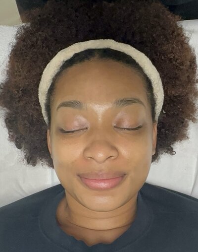 Photo of a woman receiving the Lit From Within Brightening Facial at Refined Medical NY in East Setauket Long Island, designed to improve skin tone, radiance, and overall complexion as part of the clinic’s advanced facial services.