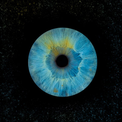 Speckle