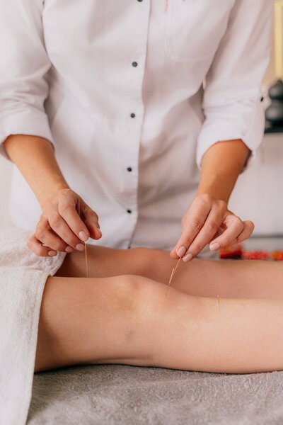 Centro Holístico provides expert acupuncture services in Sayulita and San Pancho, Nayarit, Mexico—offering holistic treatments to support balance, pain relief, and overall wellness.