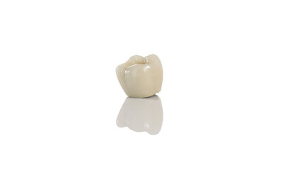 Olympus-Dental-Ceramics-Porcelain-Fused-to-Gold-125